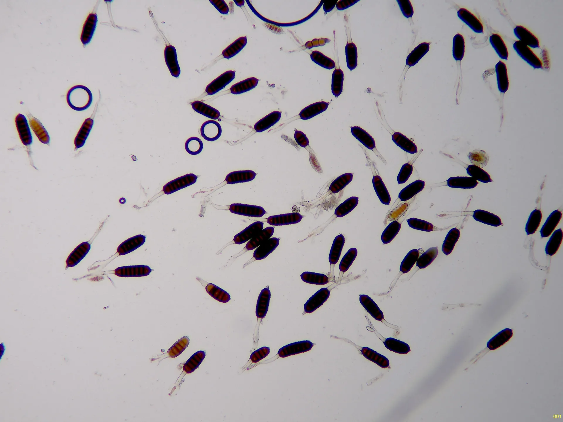 Microscopía de Phragmidium bulbosum - 11 - Teliosporas x 100-001